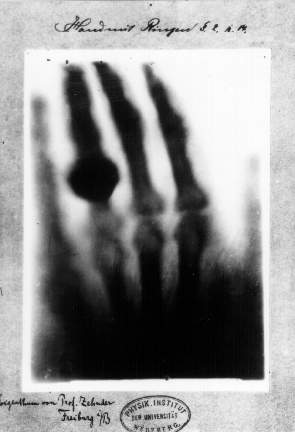 First_medical_X-ray_by_Wilhelm_Röntgen_of_his_wife_Anna_Bertha_Ludwig's_hand_-_18951222